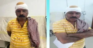 सासाराम में पथराव की घटना में घायल कपड़ा व्यवसायी।